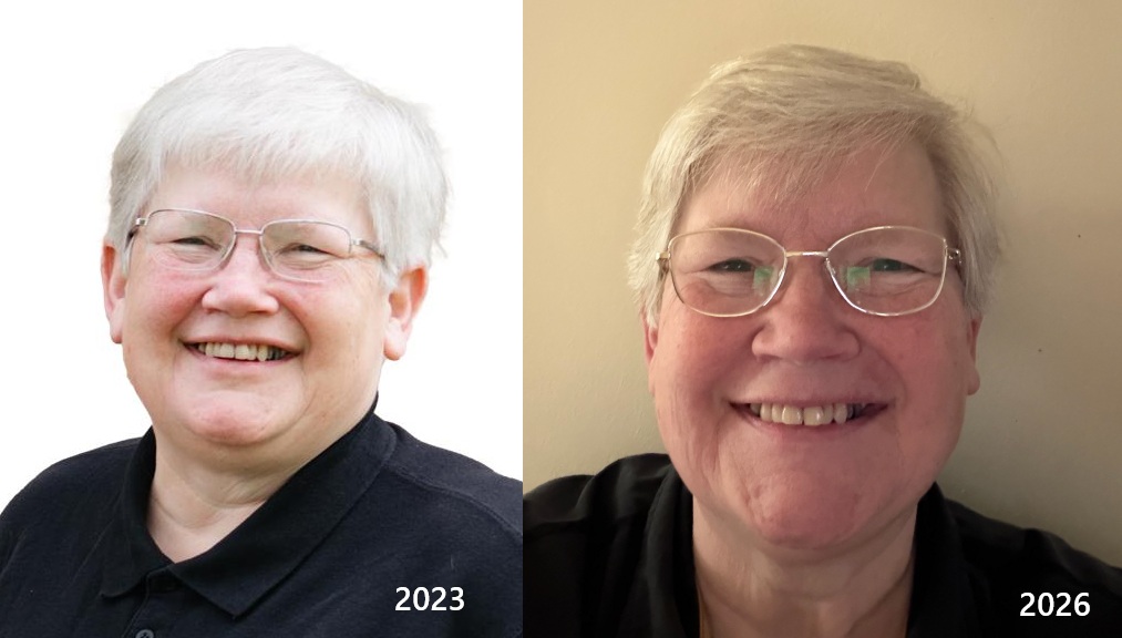 Sue Hill before and after transformation from 2023 to 2026